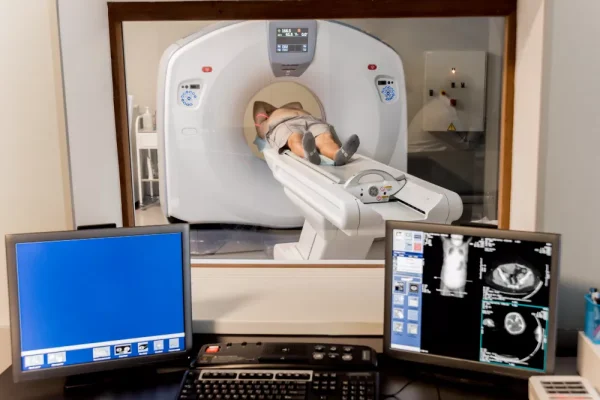 Bilgisayarlı Tomografi