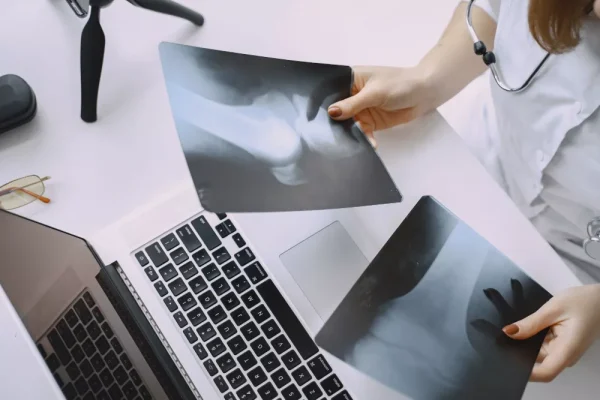 Digital X-ray
