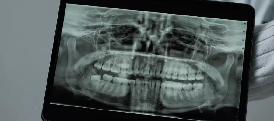 Panoramik Röntgen Panoramik Röntgen