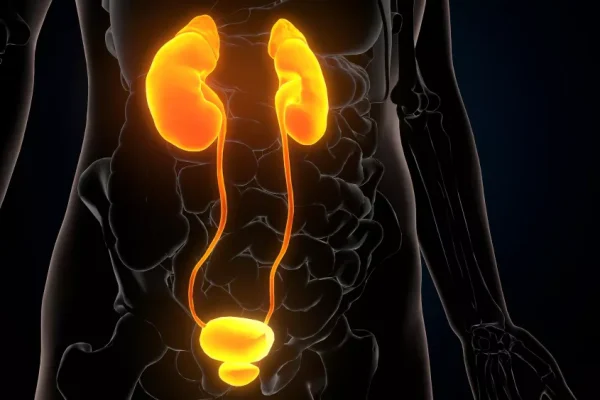 Voiding Sistoüretrografi- İşeme Filmi (VCUG)