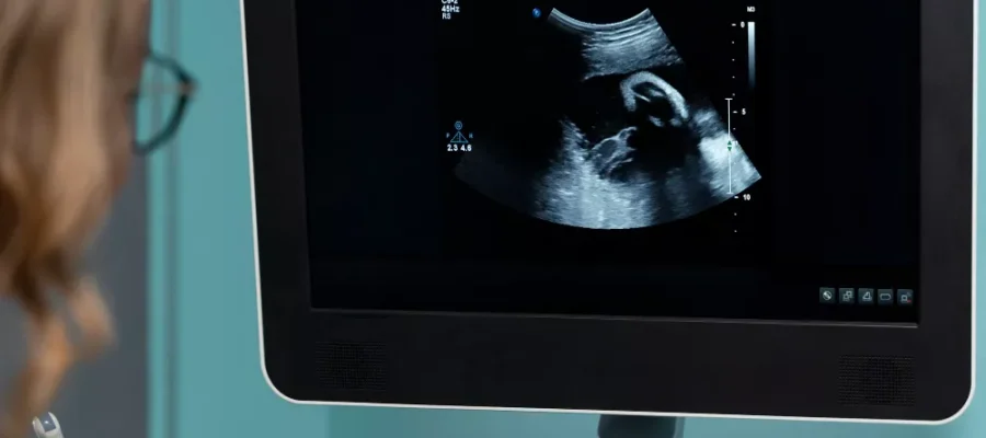 3 Tesla Fetal MR 3 Tesla Fetal MR