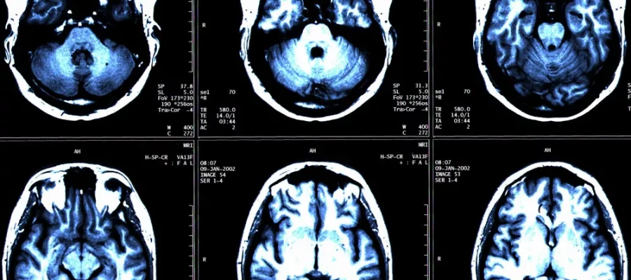 Brain Segmentation with Artificial Intelligence Brain Segmentation with Artificial Intelligence